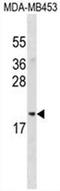 Acireductone Dioxygenase 1 antibody, AP50094PU-N, Origene, Western Blot image 