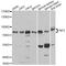 Neurofibromin 2 antibody, A0739, ABclonal Technology, Western Blot image 