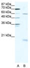 SRY-Box 9 antibody, TA330073, Origene, Western Blot image 