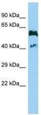 Adhesion G Protein-Coupled Receptor G5 antibody, TA334304, Origene, Western Blot image 