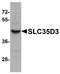 Solute Carrier Family 35 Member D3 antibody, A15258, Boster Biological Technology, Western Blot image 