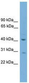 Hyaluronan and proteoglycan link protein 4 antibody, TA338632, Origene, Western Blot image 