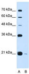 DCTP Pyrophosphatase 1 antibody, TA339363, Origene, Western Blot image 