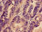 Phosphatidylinositol 3,4,5-trisphosphate-dependent Rac exchanger 1 protein antibody, LS-C679146, Lifespan Biosciences, Immunohistochemistry paraffin image 