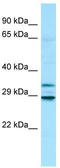 Metaxin 3 antibody, TA338290, Origene, Western Blot image 