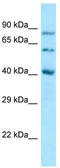 Sulfatase Modifying Factor 1 antibody, TA337720, Origene, Western Blot image 