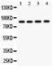 NADPH oxidase 5 antibody, PA1947, Boster Biological Technology, Western Blot image 