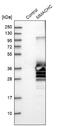 Metabolism Of Cobalamin Associated C antibody, NBP1-86598, Novus Biologicals, Western Blot image 