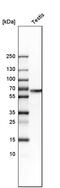 WASH Complex Subunit 1 antibody, PA5-51731, Invitrogen Antibodies, Western Blot image 