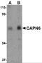 Calpain 6 antibody, 4759, ProSci Inc, Western Blot image 