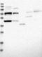Tudor Domain Containing 5 antibody, NBP1-81971, Novus Biologicals, Western Blot image 