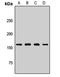 Phospholipase B antibody, LS-C668990, Lifespan Biosciences, Western Blot image 