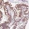 Nicotinamide Riboside Kinase 1 antibody, HPA049795, Atlas Antibodies, Immunohistochemistry frozen image 