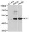 Cyclic AMP-dependent transcription factor ATF-7 antibody, A7580, ABclonal Technology, Western Blot image 