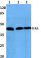 CRK Like Proto-Oncogene, Adaptor Protein antibody, A02100, Boster Biological Technology, Western Blot image 
