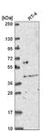 Odd-Skipped Related Transciption Factor 2 antibody, NBP2-56333, Novus Biologicals, Western Blot image 