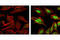 Mitogen-Activated Protein Kinase 13 antibody, 9211L, Cell Signaling Technology, Immunocytochemistry image 