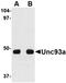 Unc-93 Homolog A antibody, orb74970, Biorbyt, Western Blot image 