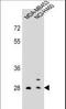 FBP antibody, LS-C166205, Lifespan Biosciences, Western Blot image 
