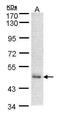 DnaJ Heat Shock Protein Family (Hsp40) Member A2 antibody, PA5-21513, Invitrogen Antibodies, Western Blot image 