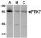 Protein Tyrosine Kinase 7 (Inactive) antibody, TA306460, Origene, Western Blot image 