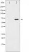 ShcA antibody, TA325839, Origene, Western Blot image 