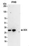 Deoxycytidine Kinase antibody, NBP2-32179, Novus Biologicals, Immunoprecipitation image 