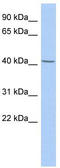 Sperm Associated Antigen 6 antibody, TA335652, Origene, Western Blot image 