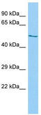 BTB Domain Containing 16 antibody, TA331654, Origene, Western Blot image 