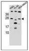 Dickkopf WNT Signaling Pathway Inhibitor 4 antibody, AP51270PU-N, Origene, Western Blot image 