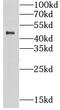 Carbohydrate sulfotransferase 15 antibody, FNab01695, FineTest, Western Blot image 