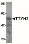 Tweety Family Member 2 antibody, NBP2-41177, Novus Biologicals, Western Blot image 