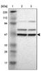 Proteasome 26S Subunit, ATPase 4 antibody, PA5-52153, Invitrogen Antibodies, Western Blot image 