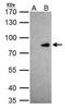 Homeobox protein cut-like 1 antibody, GTX114351, GeneTex, Immunoprecipitation image 