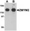 Zinc finger protein 198 antibody, TA319739, Origene, Western Blot image 