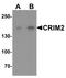 Kielin/chordin-like protein antibody, LS-C153627, Lifespan Biosciences, Western Blot image 