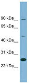 Leucine Rich Repeat Containing 49 antibody, TA344977, Origene, Western Blot image 