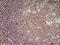 CD70 Molecule antibody, AM05527PU-T, Origene, Immunohistochemistry paraffin image 