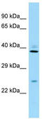 Ribosomal Protein S8 antibody, TA336113, Origene, Western Blot image 