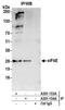 eIF4E antibody, A301-153A, Bethyl Labs, Immunoprecipitation image 