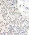 RAD23 Homolog A, Nucleotide Excision Repair Protein antibody, A302-880A, Bethyl Labs, Immunohistochemistry paraffin image 