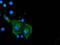 Coronin 1A antibody, MA5-25176, Invitrogen Antibodies, Immunocytochemistry image 