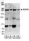 Nucleoporin 205 antibody, A303-935A, Bethyl Labs, Western Blot image 