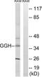 Gamma-Glutamyl Hydrolase antibody, abx014485, Abbexa, Western Blot image 
