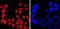 Mi antibody, A00269-2, Boster Biological Technology, Immunocytochemistry image 