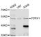 Purinergic Receptor P2X 1 antibody, A11817, ABclonal Technology, Western Blot image 