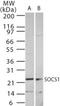 Suppressor Of Cytokine Signaling 1 antibody, TA336433, Origene, Western Blot image 