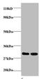 Rho/Rac Guanine Nucleotide Exchange Factor 18 antibody, A51713-100, Epigentek, Western Blot image 