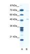 Pancreatic Lipase antibody, NBP1-57981, Novus Biologicals, Western Blot image 