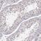 Purine Nucleoside Phosphorylase antibody, PA5-51616, Invitrogen Antibodies, Immunohistochemistry paraffin image 